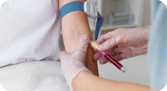 Lab Tests & Blood Work